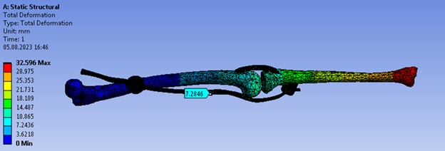 Биомеханика коленного сустава — Abaqus